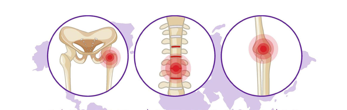 Best Doctor for Arthritis in Borivali